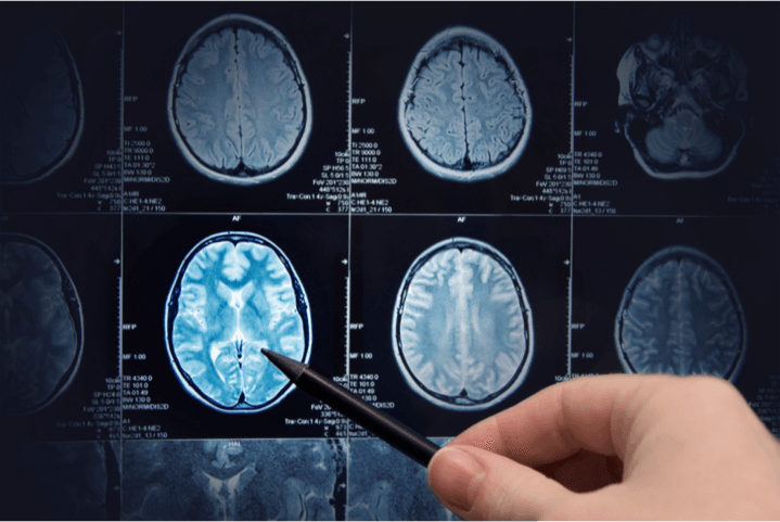 After Reporting 8.5 Mn Radiology Reports, Here’s How 5C Network has Built the Future of Radiology Reporting